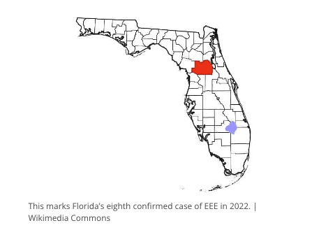 Eastern equine encephalitis